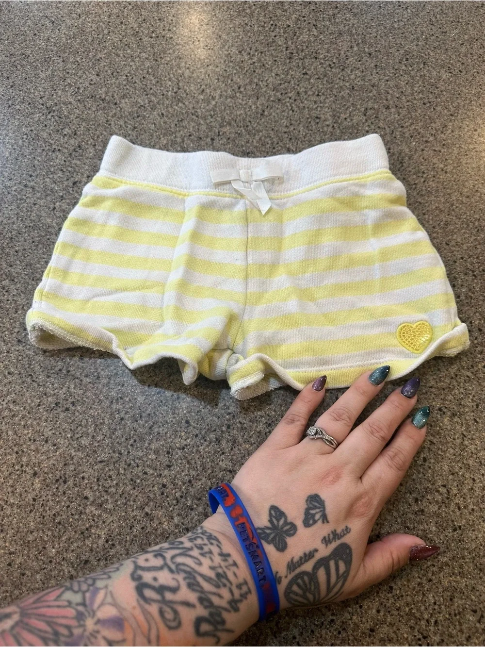Yellow & White Striped Knit Shorts